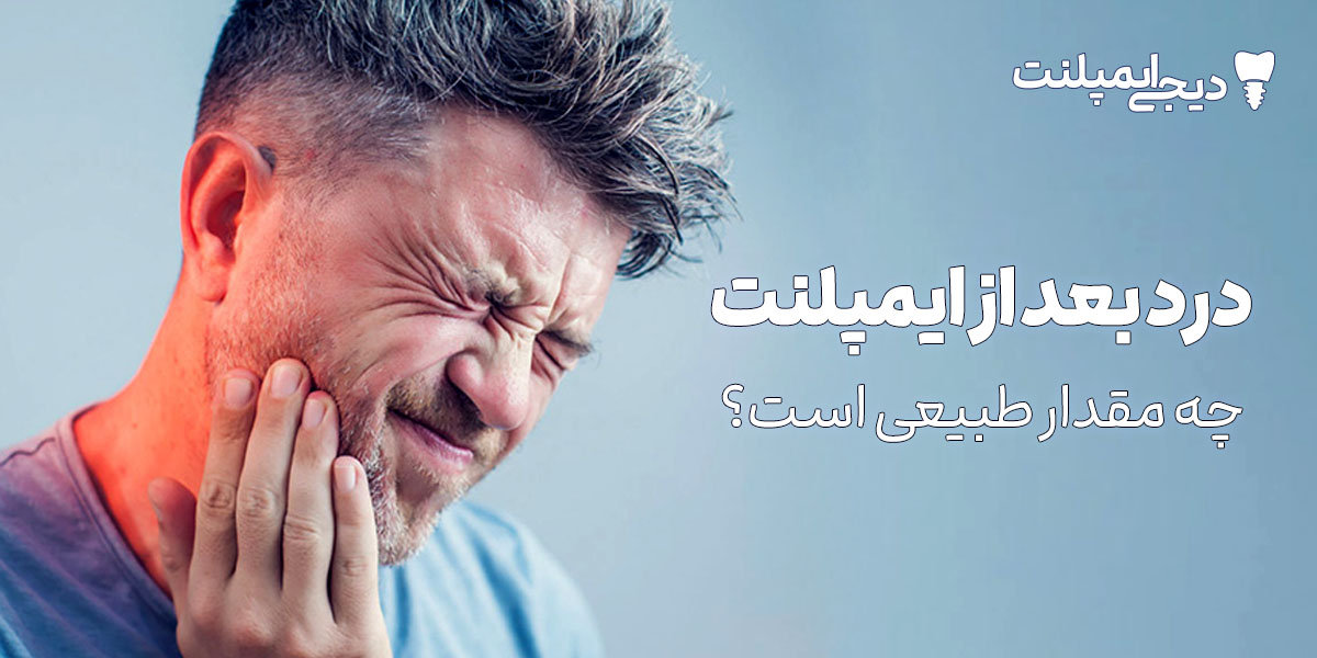درد بعد از ایمپلنت تا چند روز طبیعی است؟ (علائم خطرناک + درمان)