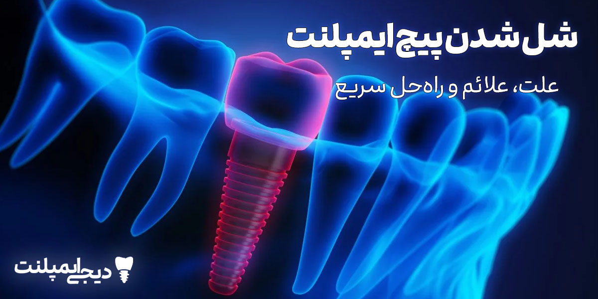 شل شدن پیچ ایمپلنت: علت، علائم و راه حل فوری (نگران نباشید!)
