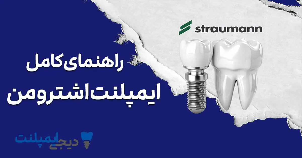 ایمپلنت اشترومن (Straumann): راهنمای کامل انواع، قیمت ۱۴۰۴ و مزایا