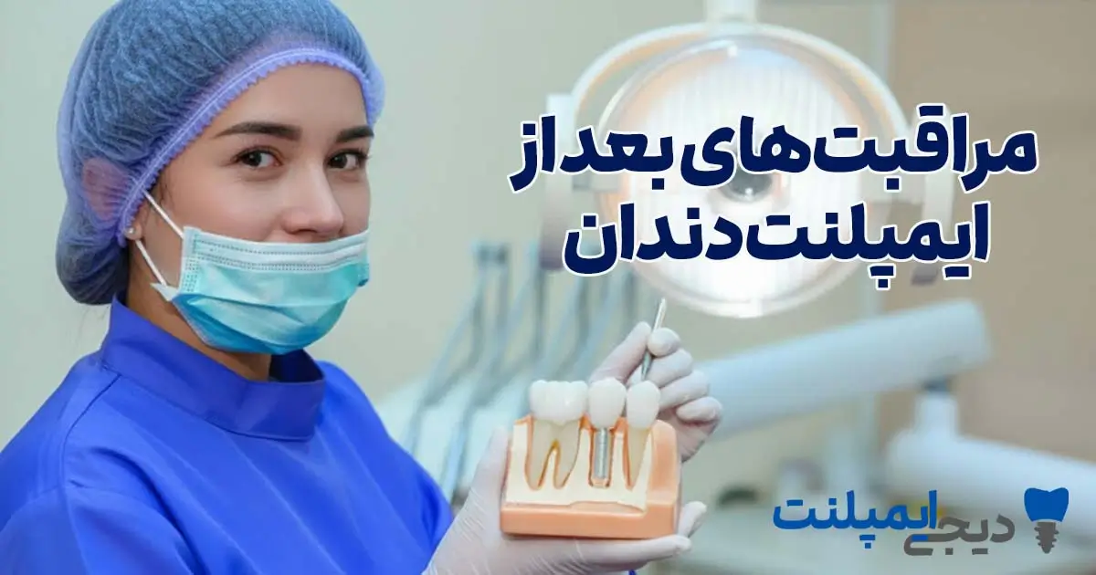 مراقبت های بعد از ایمپلنت