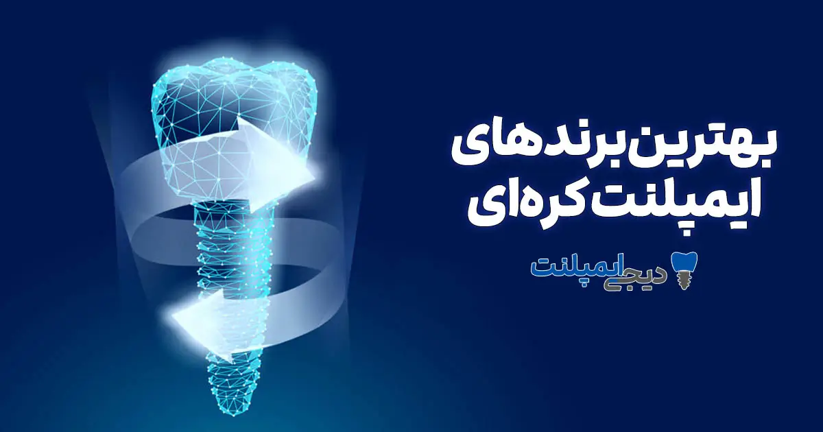 مقایسه بهترین برندهای ایمپلنت کره‌ای ۱۴۰۴: کدام برای شما مناسب است؟