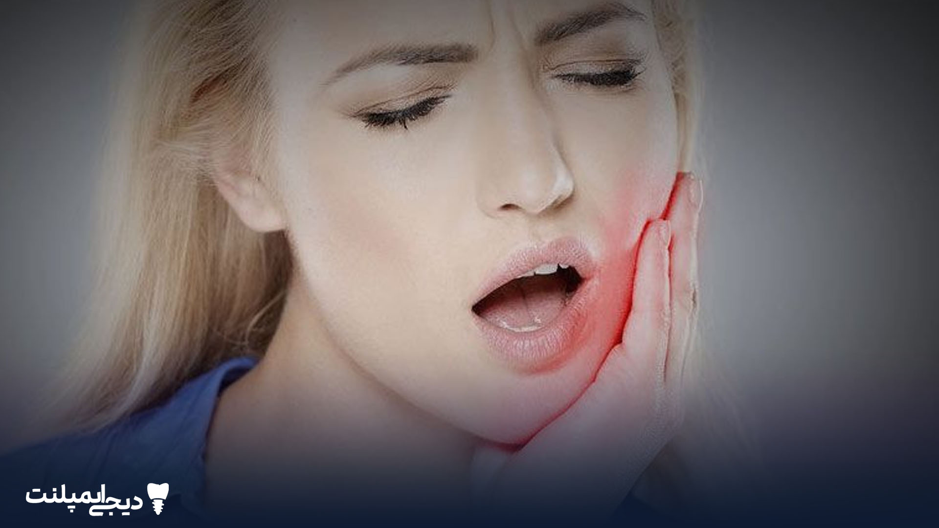 ورم بعد از ایمپلنت