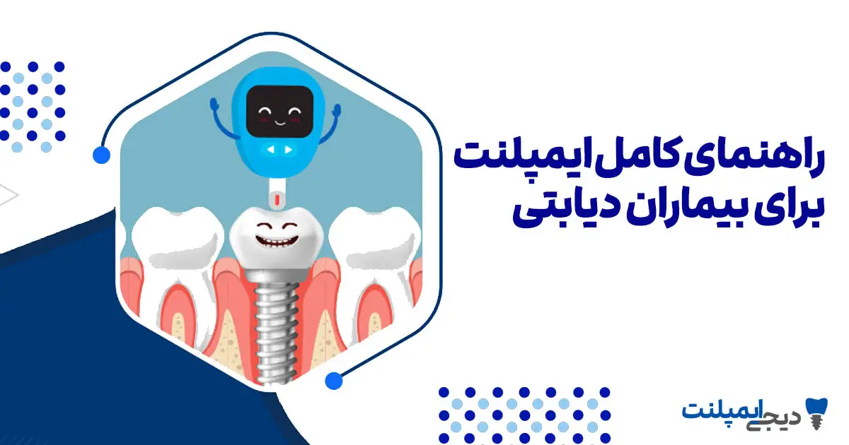 ایمپلنت برای افراد دیابتی: آیا ممکن است؟ (راهنمای کامل + شرایط)