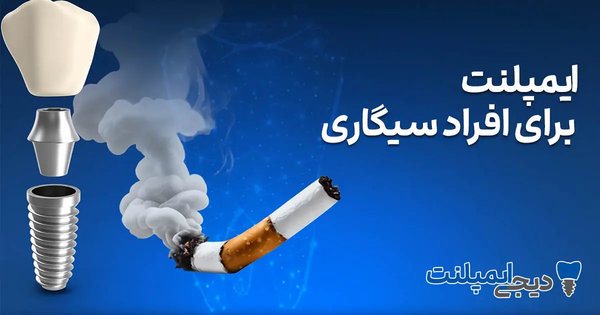 ایمپلنت برای افراد سیگاری