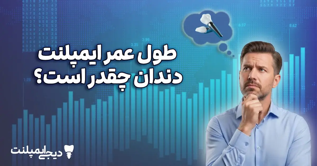 طول عمر ایمپلنت دندان چقدر است؟ (عوامل موثر + راهکارهای افزایش عمر)