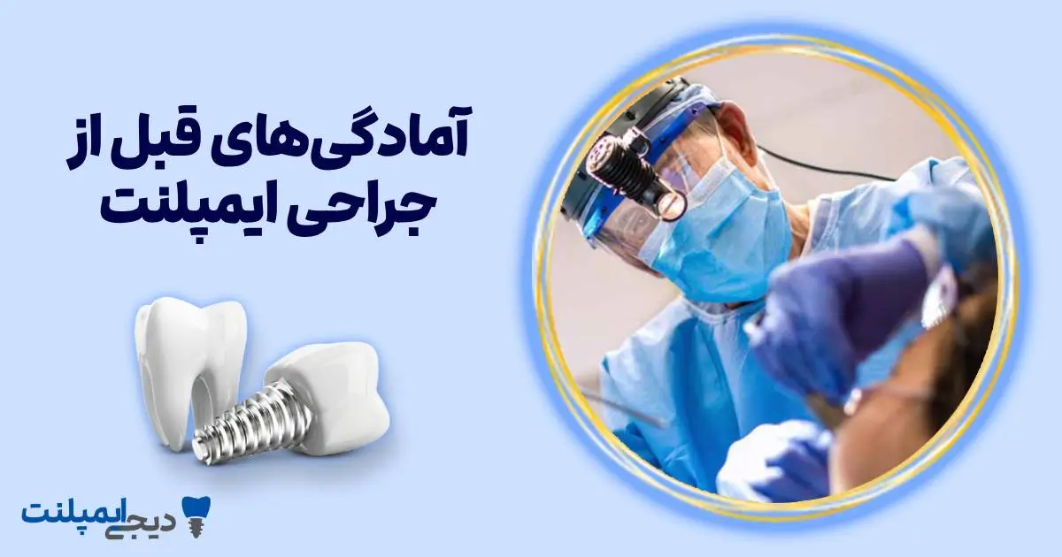 آمادگی‌های قبل از جراحی ایمپلنت (نکات کلیدی که باید بدانید)