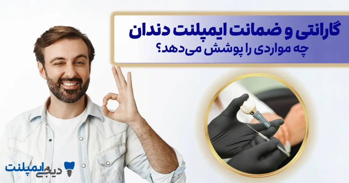 گارانتی ایمپلنت دندان: چه مواردی را پوشش می‌دهد؟ (ضمانت مادام العمر)