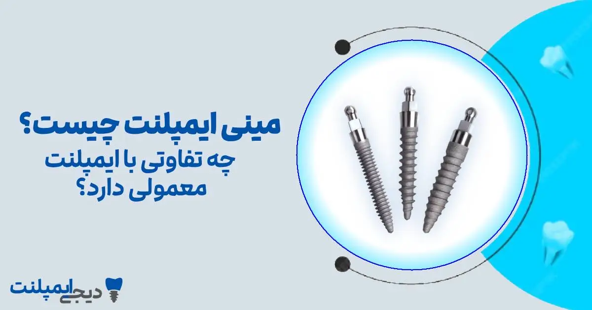 مینی ایمپلنت چیست