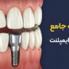 بهترین برند ایمپلنت دندان چیست؟ (مقایسه جامع برندهای سوئیسی، آلمانی و کره‌ای)